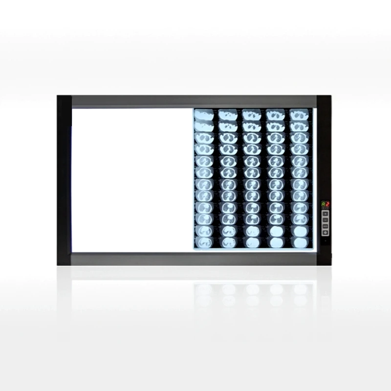 THR-VL01 Hospital Ultra-Thin Film Viewer Negatoscope X-Ray LED Light Lamp Electric Power Plastic Material