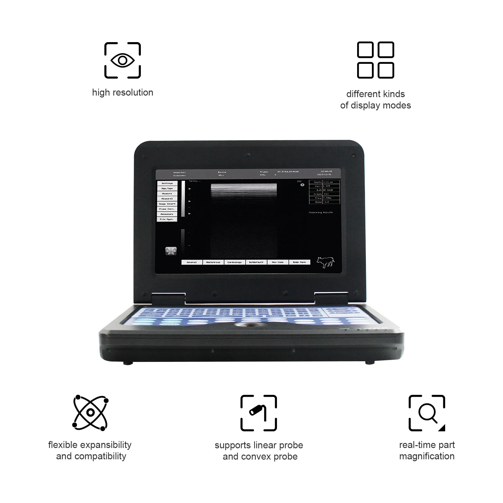 Color Tablet Ultrasound Portable Usg Machine Full Digital Portable B/W Ultrasound Scanner For Human