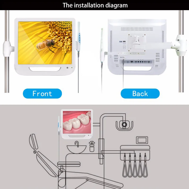 17 Inch Monitor USB / Wifi Intraoral Endoscope New Arrival 6 Led Camera Dental Camera Dental Light Dentist Endoscope Camera