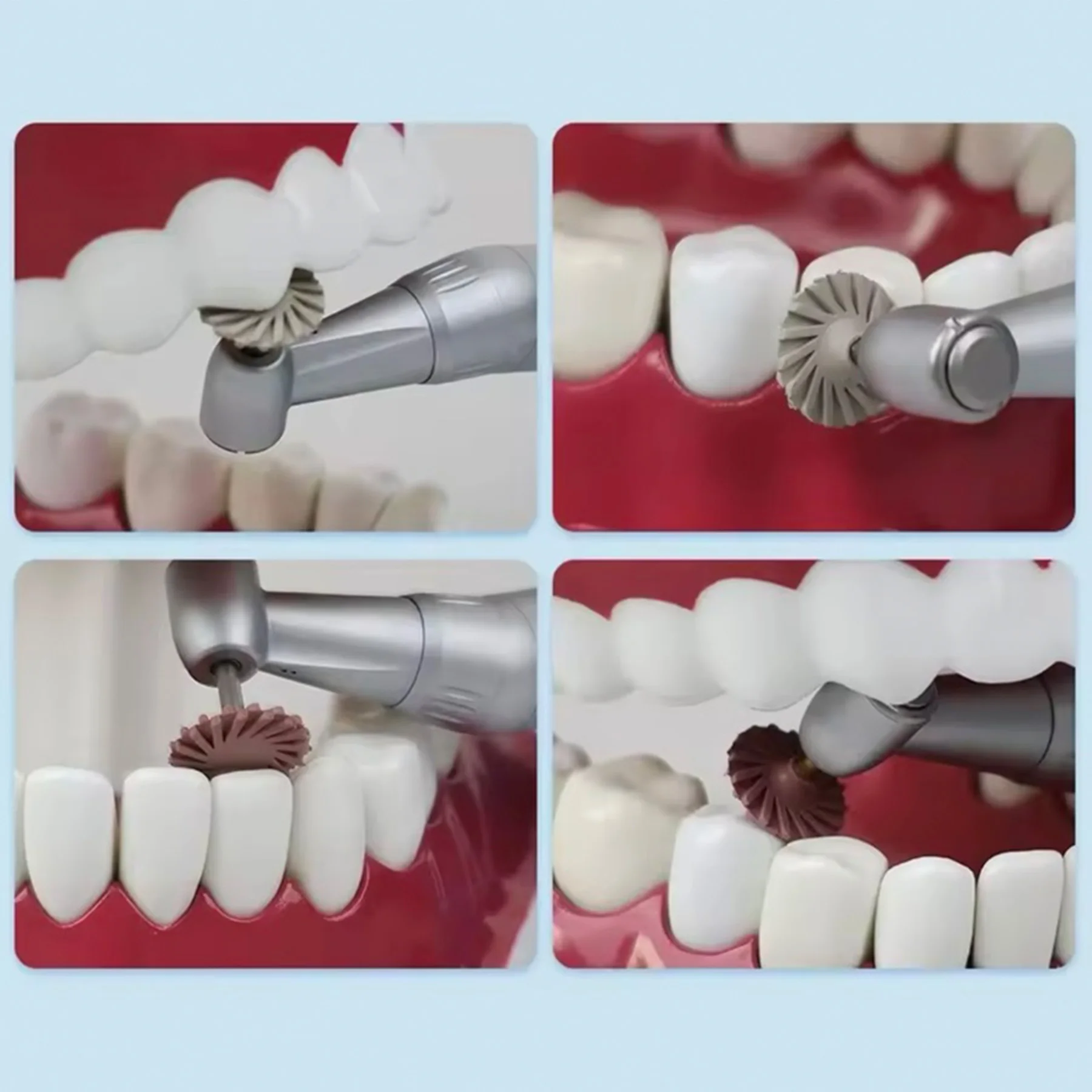 

Dental Rubber Polisher Composite Resin Polishing Set Dia 2.35mm For Low Speed Handpiece 3 Colors Spiral Flex Brush Dentist Tool