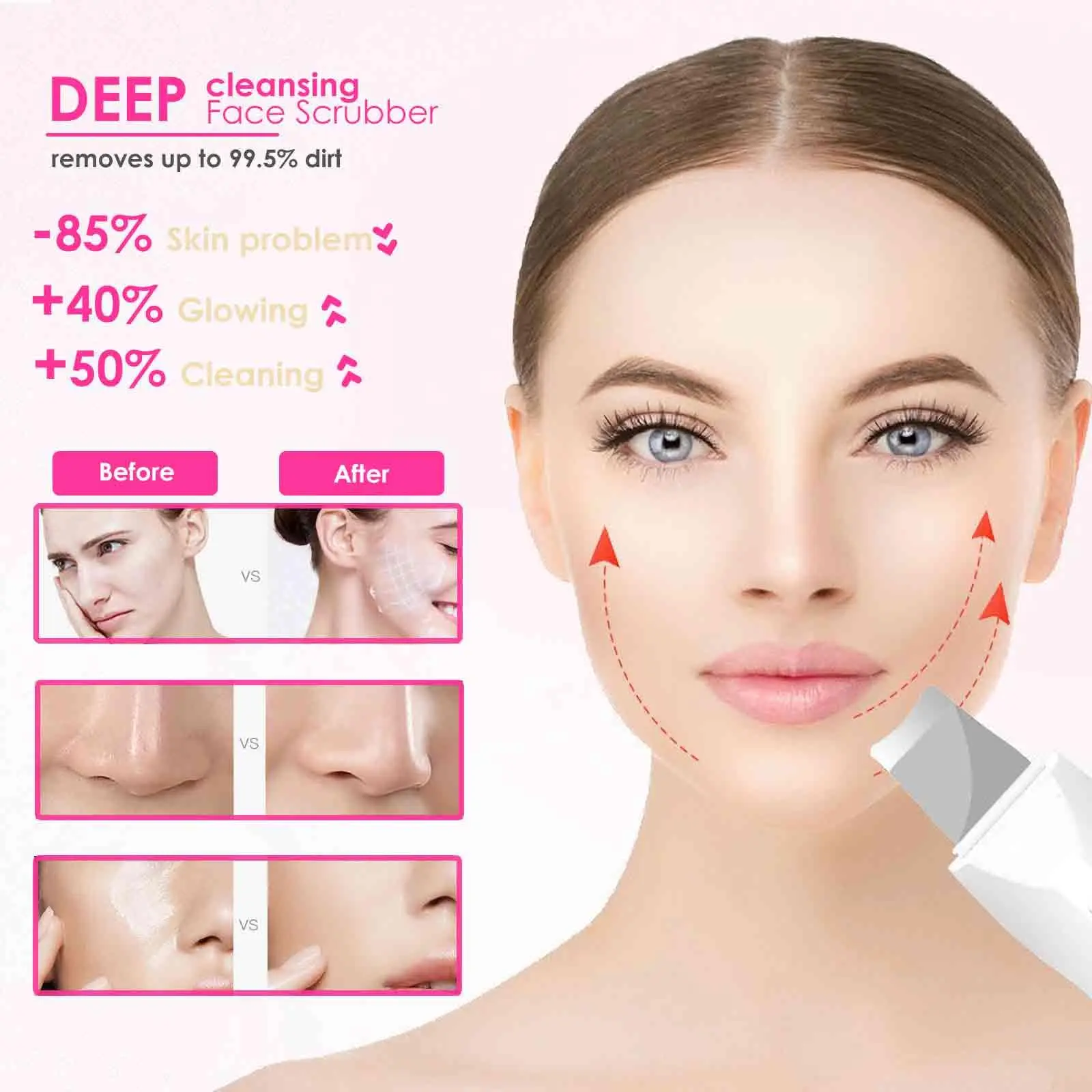 เครื่องขัดผิวด้วยคลื่นอัลตราโซนิก เครื่องขัดผิวหน้า - เครื่องขัดผิวหน้า กำจัดสิวเสี้ยน ทำความสะอาดรูขุมขน พร้อมโหมดการทำงาน 3 โหมด อุปกรณ์ดูแลผิว