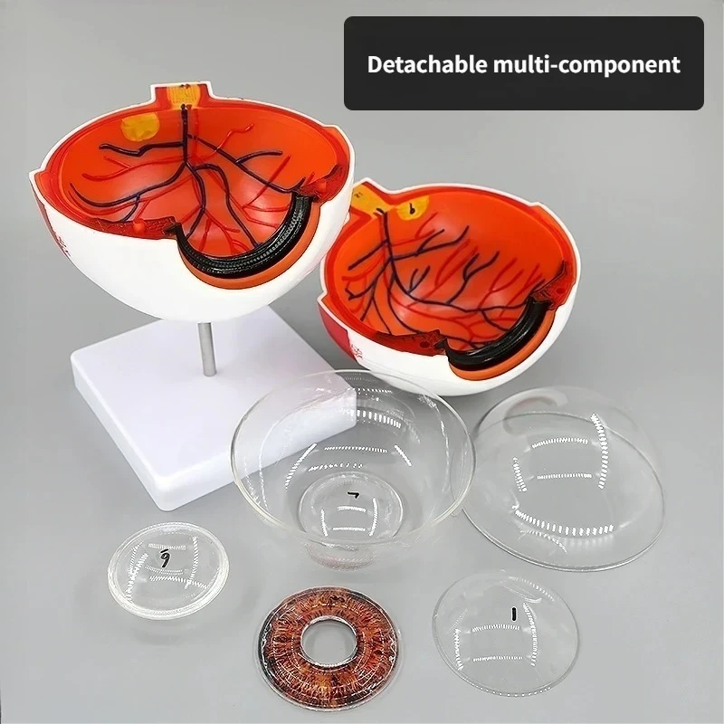 6 Times Human Eye Anatomy Model ENT Ophthalmology Eyeball internal structure Cornea iris lens vitreous