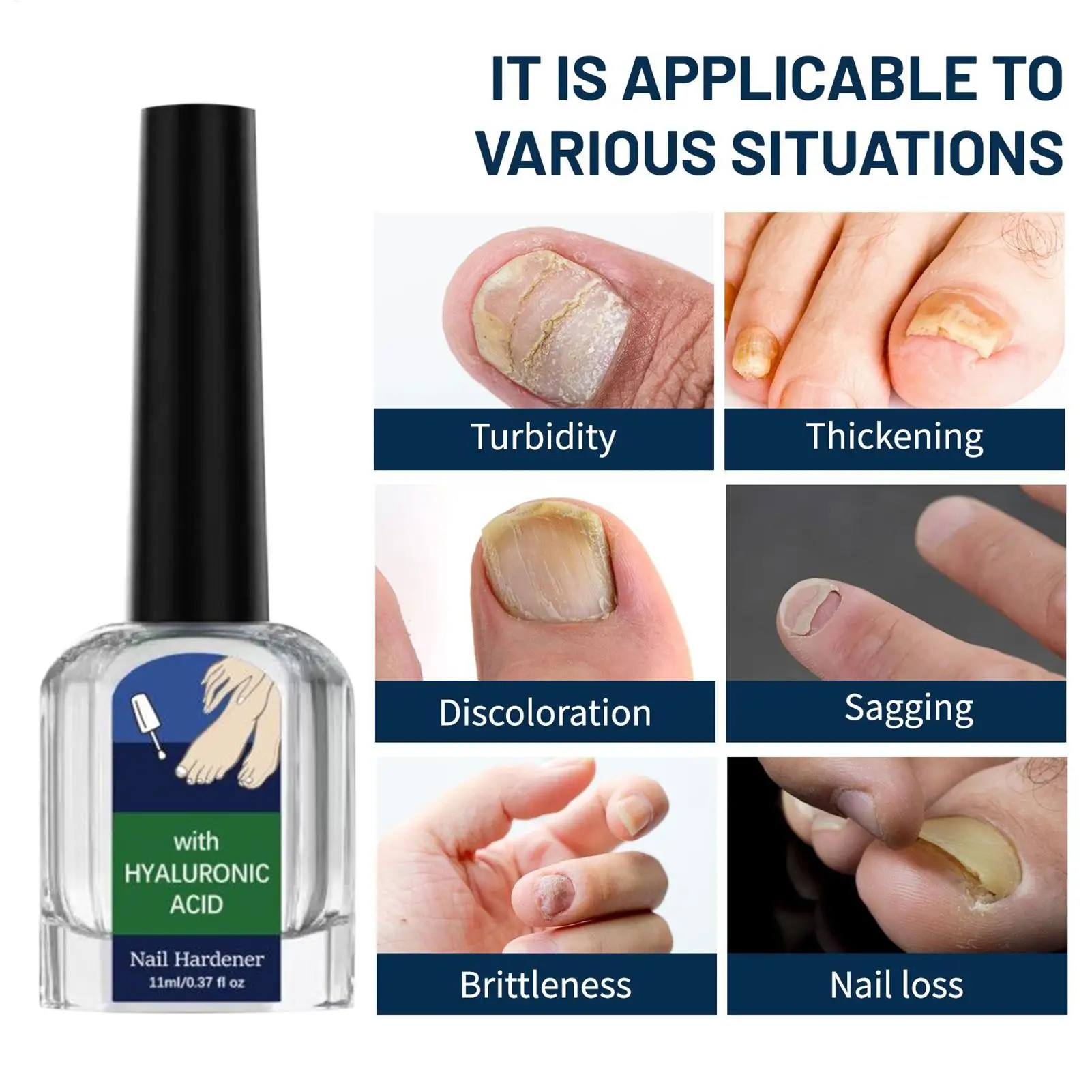 مقوي الأظافر الواقي اللطيف والامتصاص السريع لنمو الأظافر وكيل سائل لأظافر القدم والأصدقاء والزملاء المتحمسين في المنزل