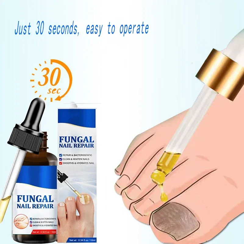 Anti Infection Toe Fungus Hand Foot Removal Repair oil Nail fungus treatment serum removal and repair of nail fungi