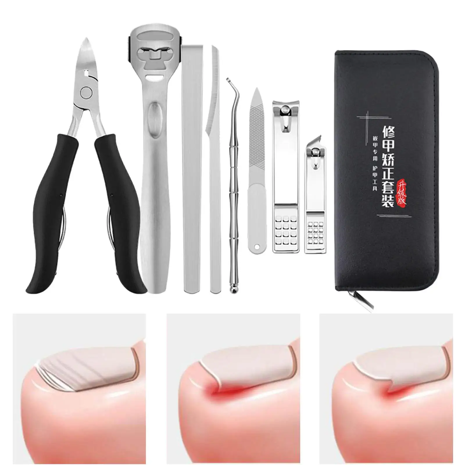 Coupe-ongles pour orteils, Correction des ongles, en acier inoxydable, pour ongles incarnés épais