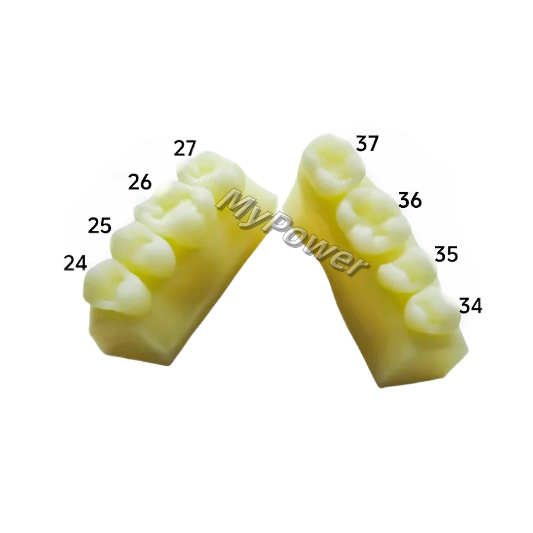 1Set Dental Composite Resin Teeth Filling Molar Anterior Cavity Hole Practise Model