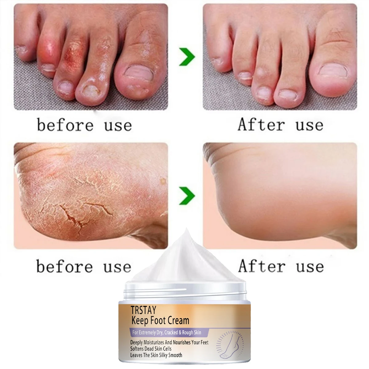 Cracked Heel Balm Cream for Rough Dry Cracked Chapped Hand/Feet Heel Skin Care Cream Natural Essence Skin Care for Body