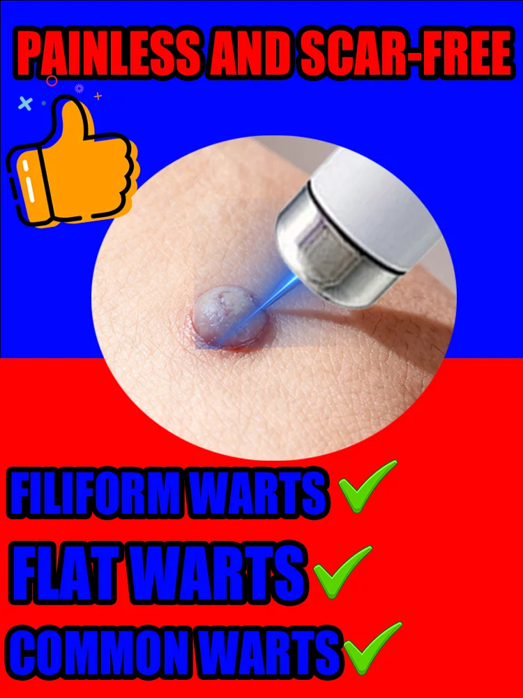 

Wart and Papilloma Removal - Plasma for Face/Body Dark Spots | Safe for Home Use