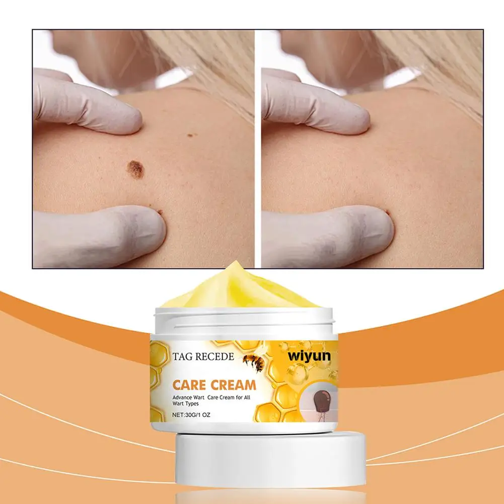 Bienen warze Pflege creme Entfernung Warze feuchtigkeit spendende und glättende Hautpflege creme Reparatur Hautrötung und Juckreiz Körperpflege 30g