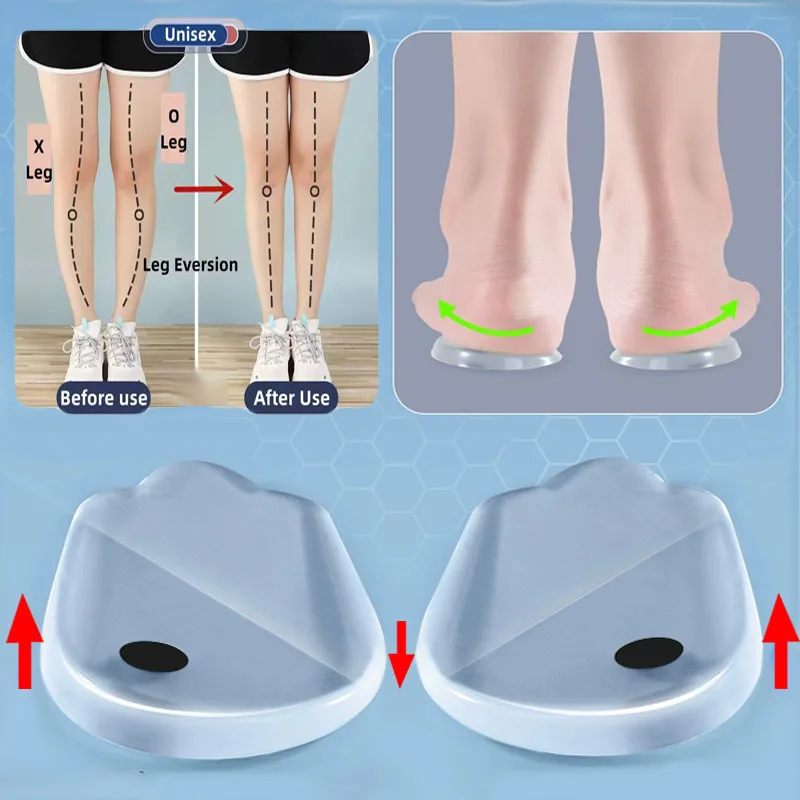 Magnetic Orthopedic Insoles for Shoes Man Woman Plantar Fasciitis Relief O/X Legs Knee Varus Correction Silicone Shoe Heel Pads