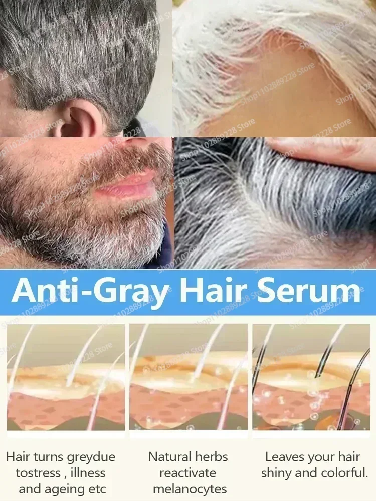 Sérum naturel anti-cheveux gris, réparation des cheveux blancs et assombrissants, soin nourrissant