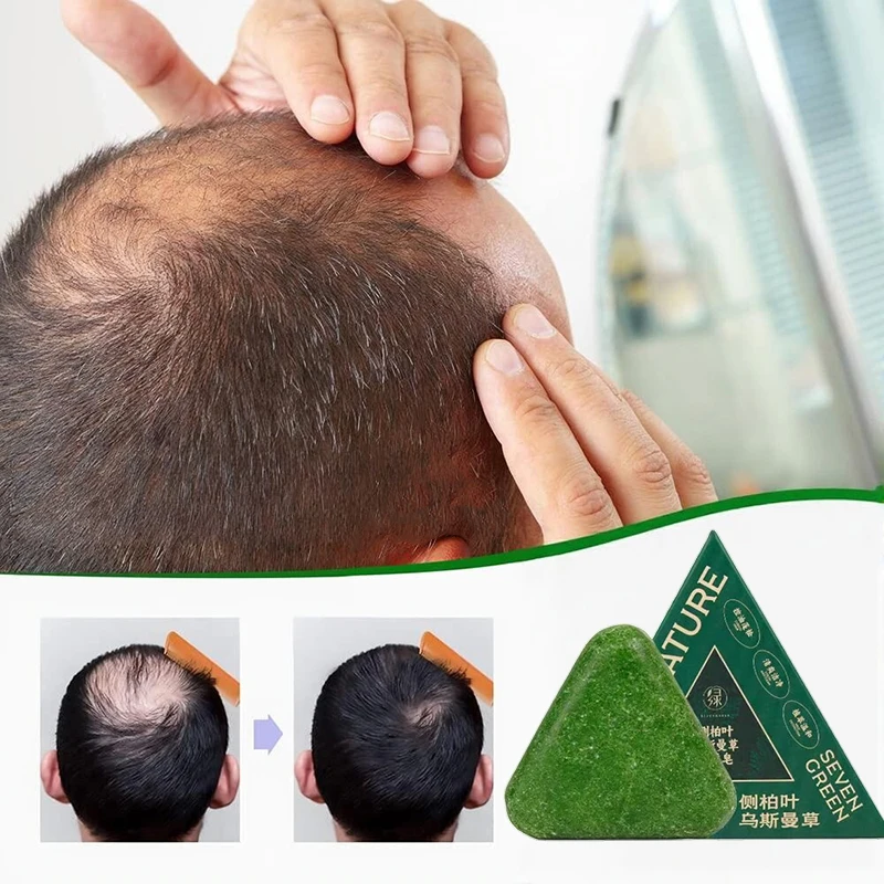 Barra de champú Usman Grass & Platycladus para el crecimiento del cabello, jabón de hierbas naturales para la caída del cabello, controla el aceite, fortalece las raíces, champú