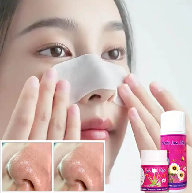 Aloe Vera Blackhead Remover Kit, Gentle Pore Strips & Nose Mask Set, Natural Acne Deep Cleansing, Sensitive Skin