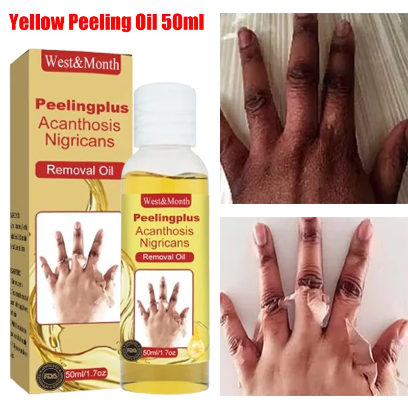 Yellow Peeling Oil Body Cleansing Exfoliation For Tender Glowing Skin Finger Joint Whitening Moisturizing Care Beauty Products