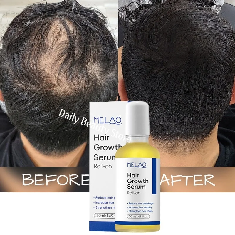 

Fast Hair Growth Serum 7 Days Anti Hair Loss Prevent Baldness Scalp Treatment Repair Roots Beauty Health Hair Care For Men Women