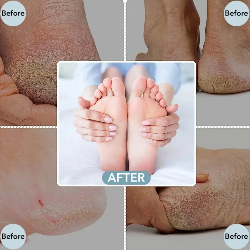 สแตนเลสสตีลเท้า Scraper เท้าโลหะแฟ้ม Double SidedCallus Remover Professional สําหรับผิวเปียกหรือแห้ง Pedicure เครื่องมือส้น