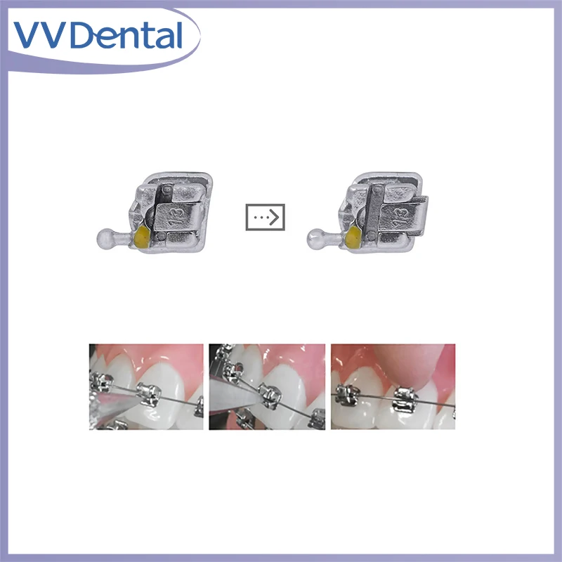 

Стоматологический материал для металла, самоделирующийся слот Roth/MBT 345, 0,02 или APC Bracket Mini Braces/ортодонтический самолигирующийся кронштейн