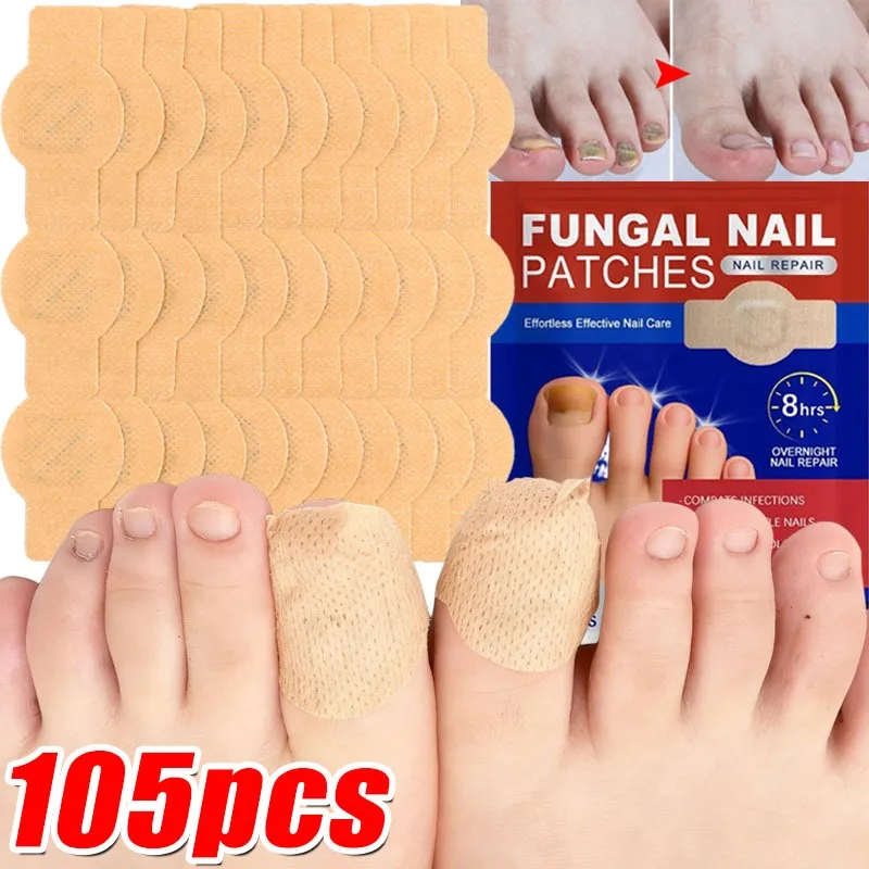 21/105 قطعة سريعة المفعول أظافر الفطريات التصحيح العلاج مقاوم للماء الطبية الصف إصلاح 8 ساعة نتائج مرئية القدم الرعاية الصحية