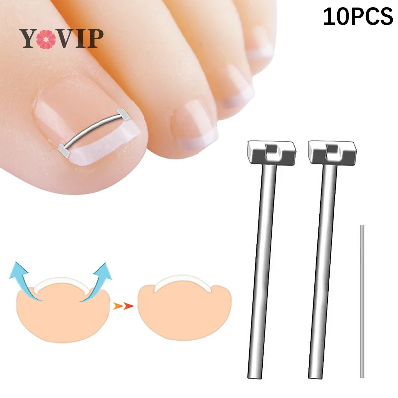 Ingrown Toenail Corrector Ferramentas, Pedicure Recuperar, Incorporar Toe Nail Tratamento, Correção unha profissional, Foot Care Tool, 10Pcs