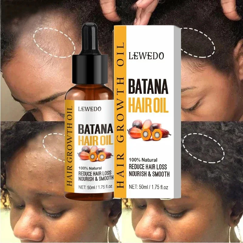 Natural 100% Pure Batana Oil For Hair Growth Butter Hair Mask Traction Alopecia Anti Hair Loss Baldness Treatment For Men Women