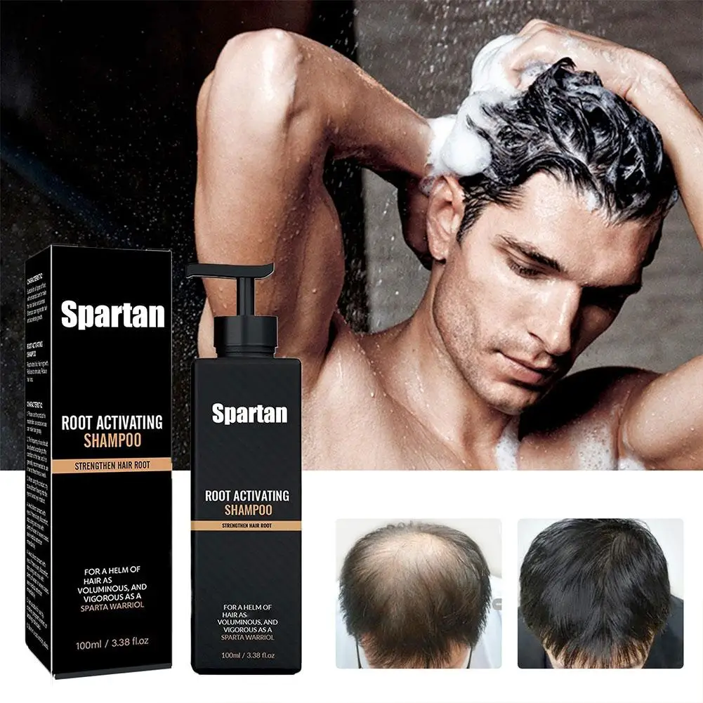 

Root Hair Care Shampoo Series Dandruff Control Reducing Brittle Pure Plant Strengthens Roots Shampoo for Hair Loss ﻿ E4U7