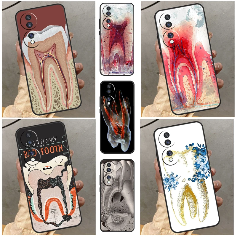 Human Tooth Anatomy Case For Huawei P20 P30 P40 P50 Pro Lite Nova 5T P Smart 2021 Honor 50 70 X7 X8 X9 Cover