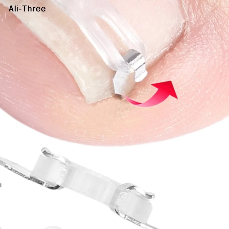 1/2 Set Ingrown Toe…