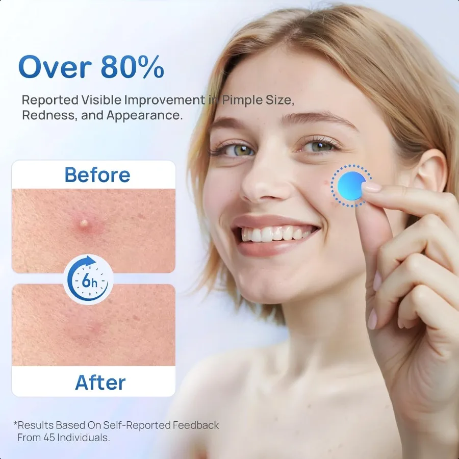 Plasterki na pryszcze do twarzy, kolorowe plasterki hydrokoloidowe na trądzik z kwasem salicylowym, olejkiem z drzewa herbacianego i centella, 3 rozmiary, 5 uroczych kształtów, do twarzy.