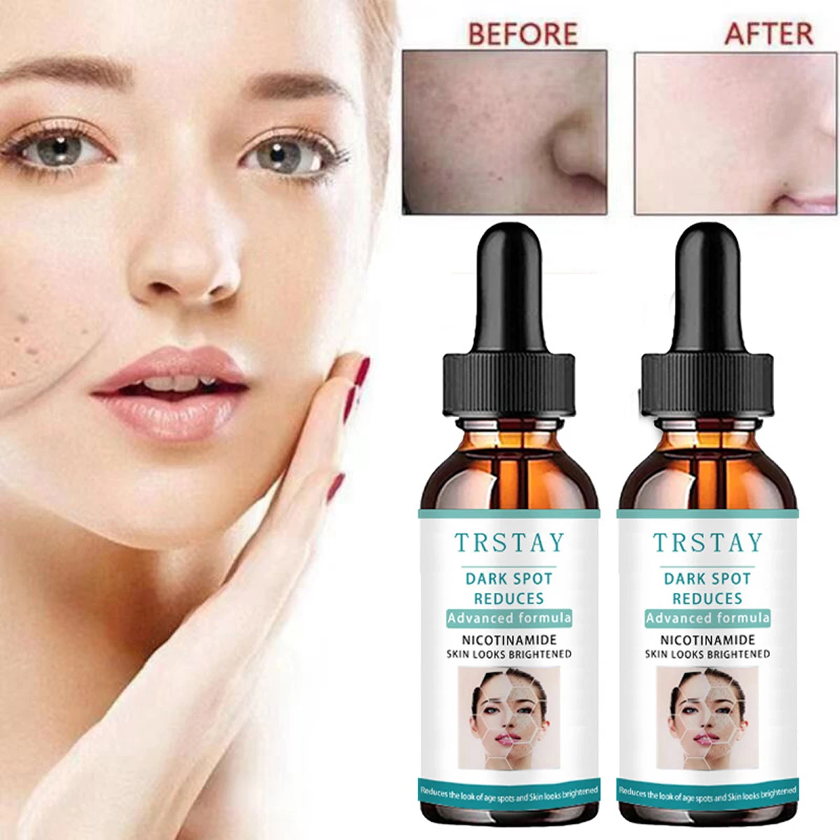 

5ML/15ML/30ML/50ML/ TRSTAY Dark Spot Reduction Advanced Formula Nicotinamide Skin Looks Bright