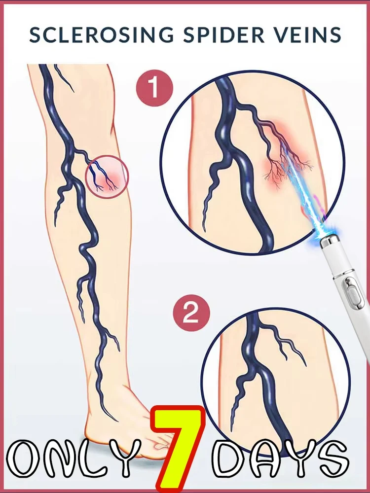 

Многофункциональная лазерная ручка нового поколения с синим светом, термогенерационный лазерный инструмент для ухода за ногами, прощайтесь к дискомфорте для ног, новинка