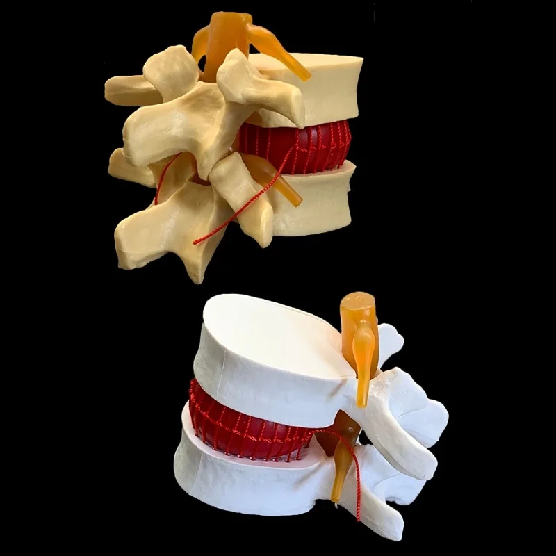 Spine Human Spine Model Full Size Demonstration Model Of Human Lumbar Intervertebral Disc Compression For Medical Teaching