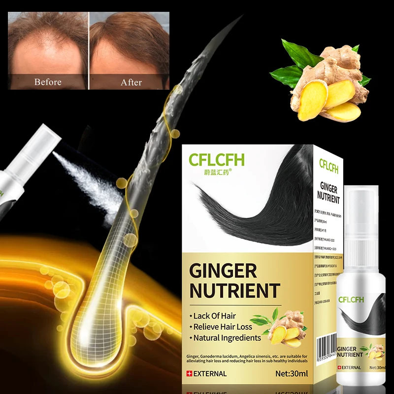 

Hair Growth Spray Scalp Hair Regrowth Care Products for Men Women Anti Hair Loss Treatment Ginger Ganoderma Lucidum Liquid 30ml