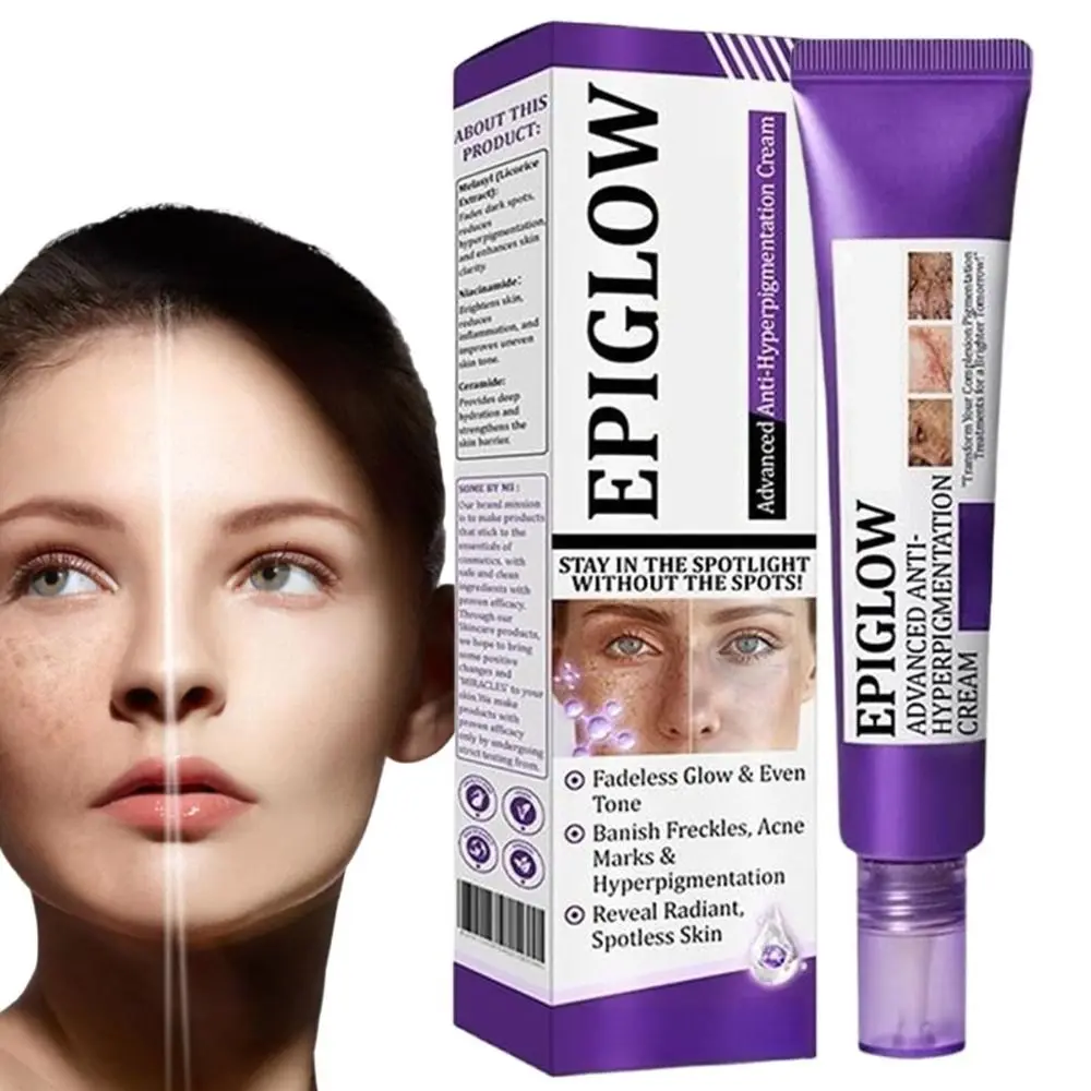 Diepe Reiniging Anti Hyperpigmentatie Crème Donkere Vlekken Remover Verhelderende Behandeling Gezichtscrème 20g Rimpel Remover Gezichtscrème