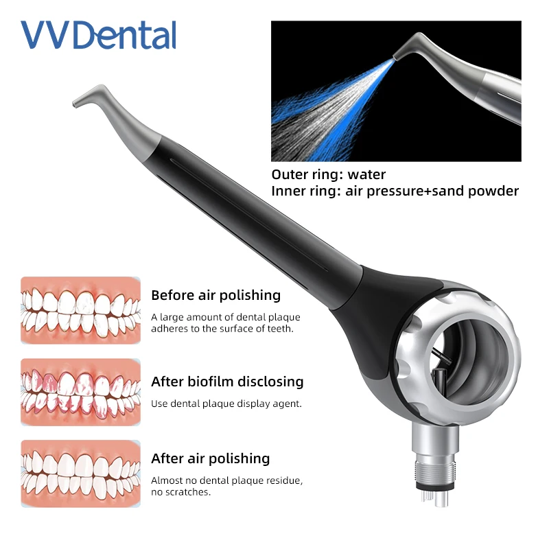 VVDental Dental Air Polisher PV-5 Periodontal Plaque & Stain Removal Handpiece for Clinic Use 0.7mm Nozzle 2/4 Hole Silver Black