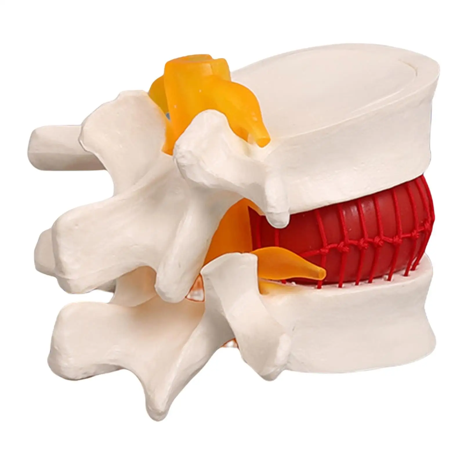 学校、人間の椎間板を教えるためのヘルニア脊椎モデル