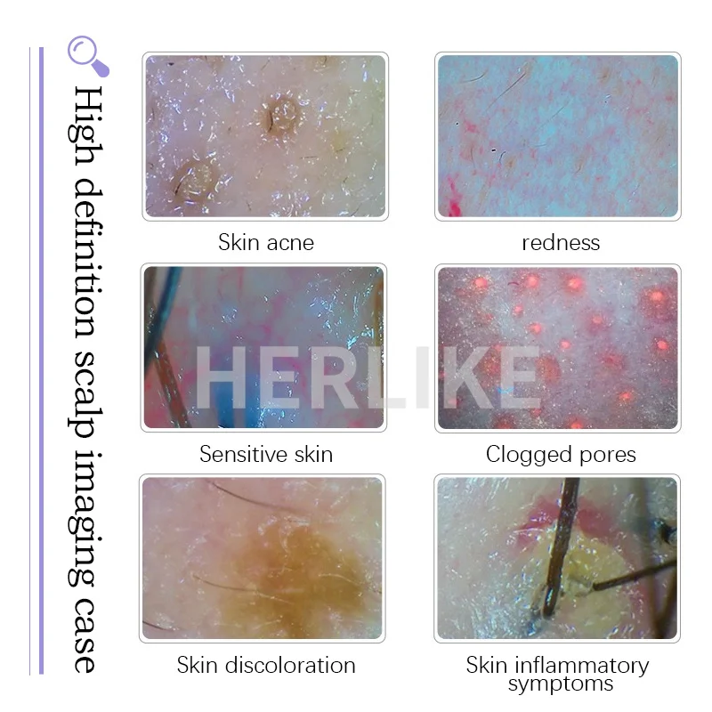 14/15 in 1 Hydra Piccola bolla Pulizia del viso Rafforzamento della pelle Rimozione dei punti neri Peeling dell'acqua Ringiovanimento della pelle Hydro Machine