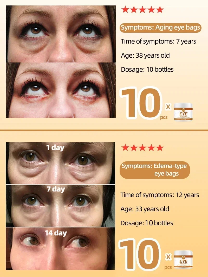 Crema para Ojos, elimina la grasa de los ojos, cuidado antihinchazón