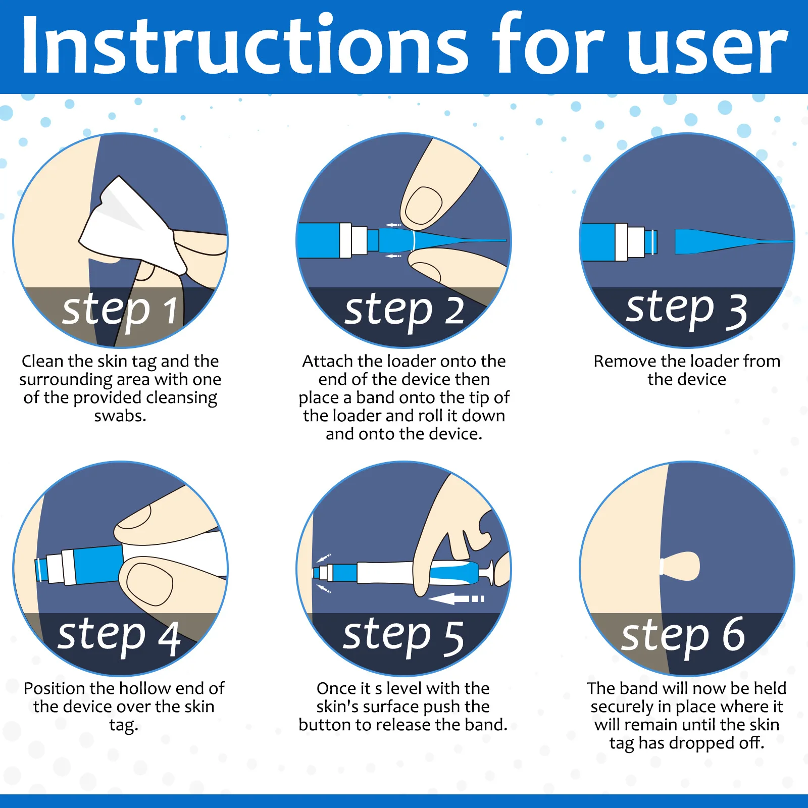 2-IN-1 السيارات الجلد علامة أداة إزالة الصواميل عدة غير مؤلم الخلد حب الشباب ثؤلول إزالة القلم الجسم ثؤلول نقطة العلاج مزيل أدوات العناية ببشرة الوجه #5