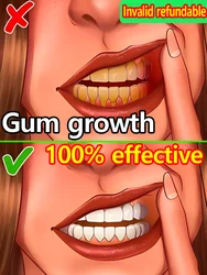 Repair gums, no more worries