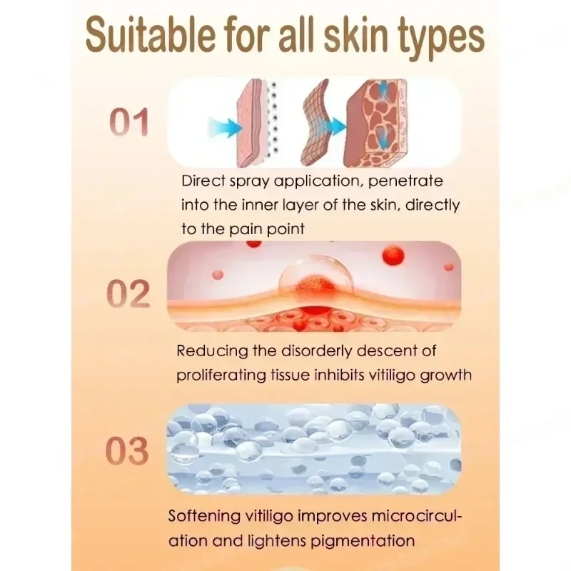 Vitiligo Cream Effectively Remove White Spot Removal Skin Vitiligo Eliminate Vitiligo Body Skin Care