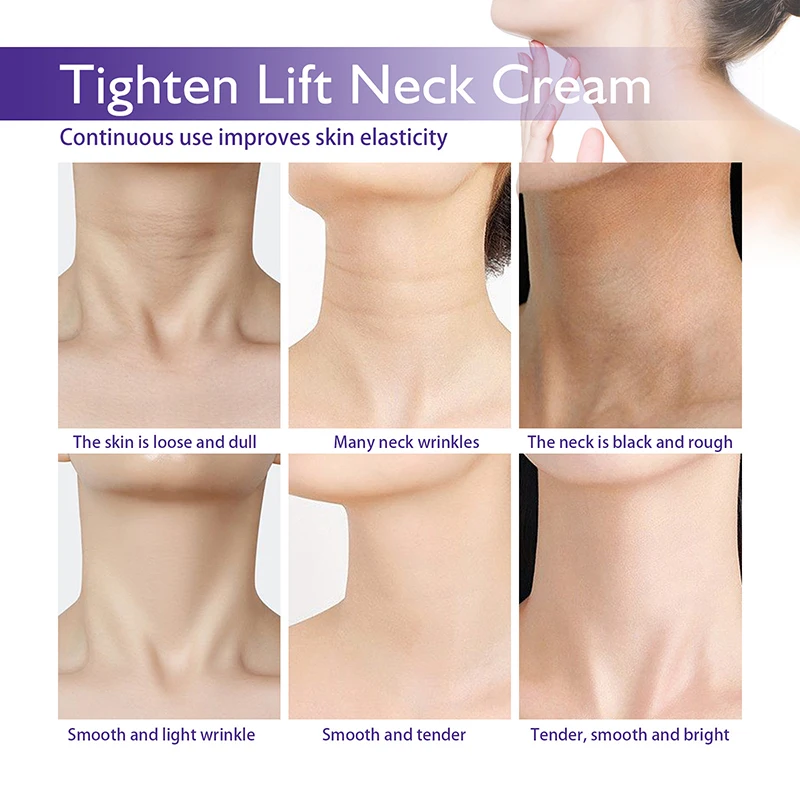 Neck Cream Neck Wrinkled Skin Hydrating And Moisturising Lifting And Firming Skin Improving Fine Neck Lines On The Neck