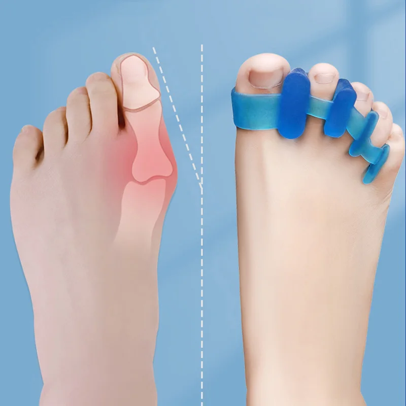 Toe Separator Hallux Valgus Corrector Bunions Finger Separator Toe Corrector Fingers Feet Haluksy Toe Spreader Bunion Corrector