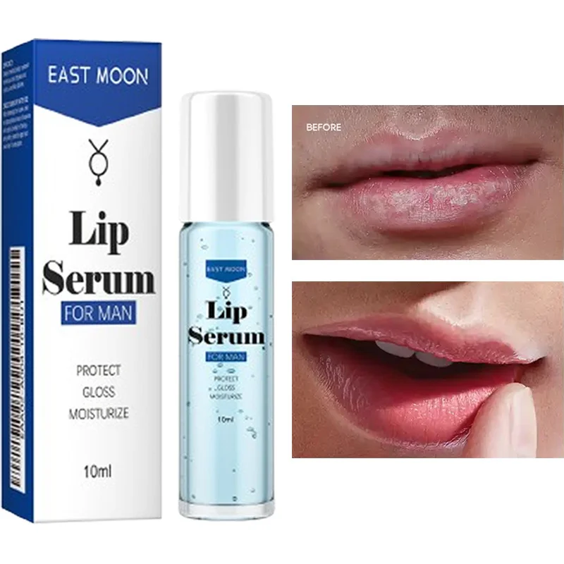 Rolling Lip Serum Fluid Exfoliate Dead Skin Remove Melanin Moisturizing Plumping Brighten Smooth Lip Skin Care For Men Lip Balm