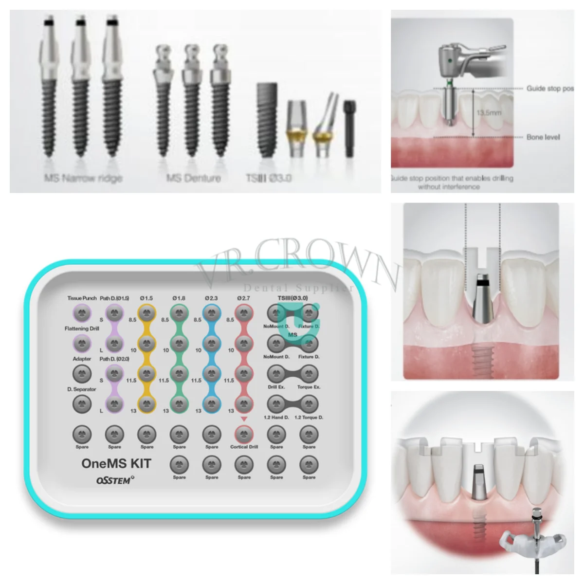 Kit Brocas Odontológicas Osstem, Implantes Place, Áreas Estreitas, Plantologia, Imologia, Novo