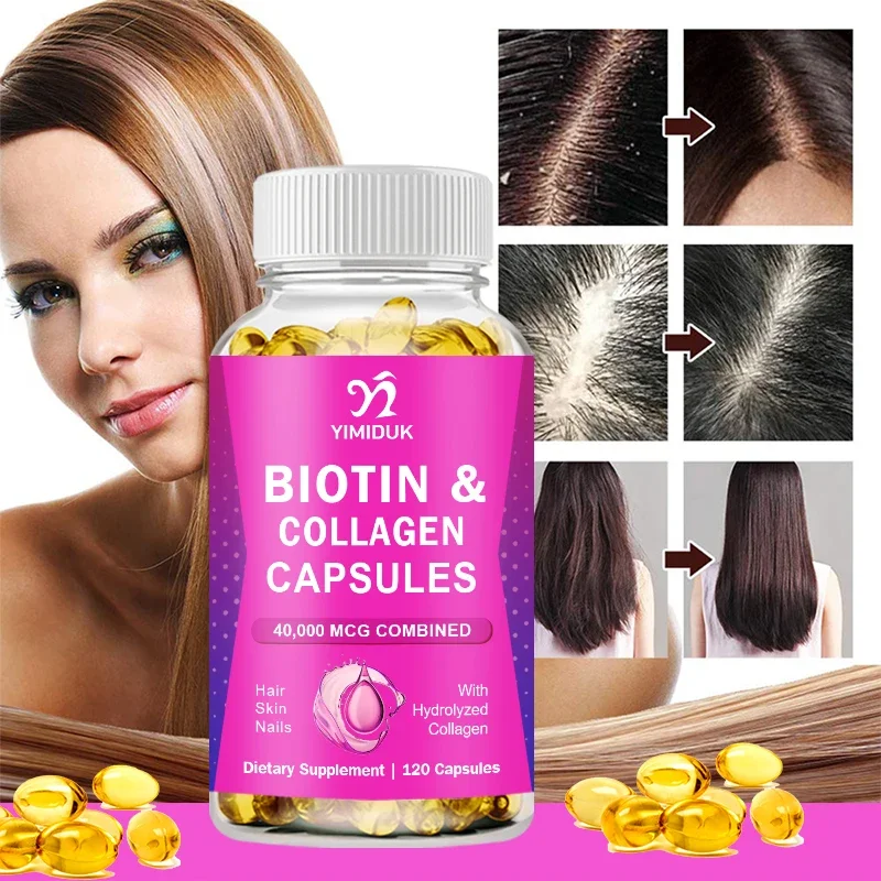 Biotina com suplemento de colágeno, suporte de proteína, fórmula antienvelhecimento, unhas fortes, cabelo brilhante, pele lisa, cápsula vegana