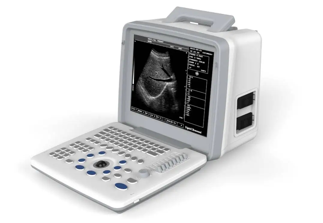 Medical Imaging Equipment Diagnostic Ultrasound System Sonoscape Portable Ob/Gyn Ultrasound Machine For Hospital