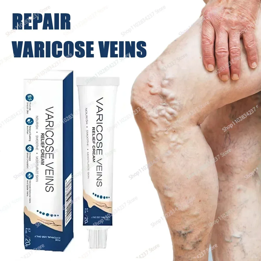 

HOT SALE Foot Health Tools for Effective Repair of Varicose Veins and Spider Legs