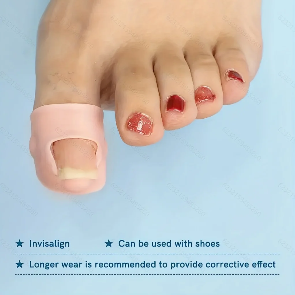 4Pcs Ingrown Toenail Correction Tool Silicone Ingrown Toe Nail Treatment Pad Groove Straightening Foot Care Tool
