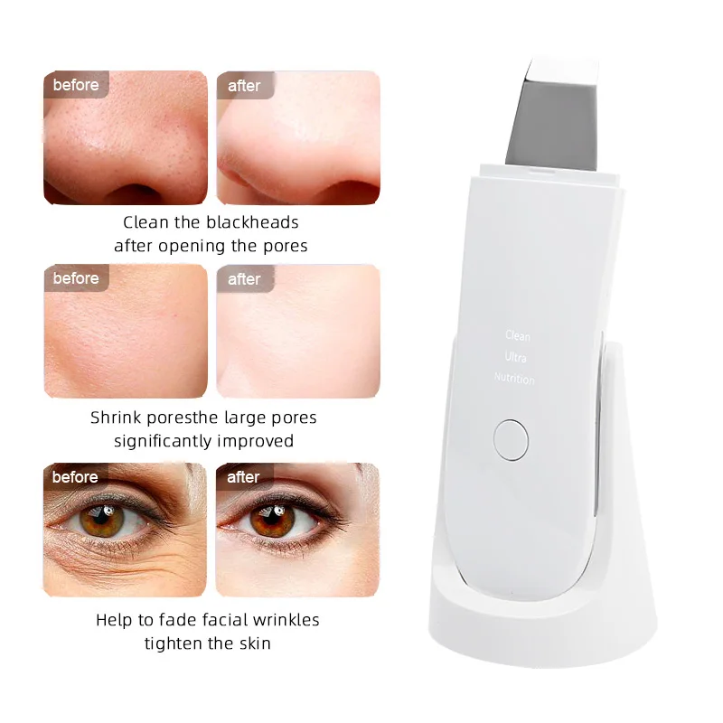 

24k Ultrasonic Skin Scrubber Deep Face Cleansing Machine Peeling Shovel Facial Pore Cleaner Blackhead Removal Lifting Device