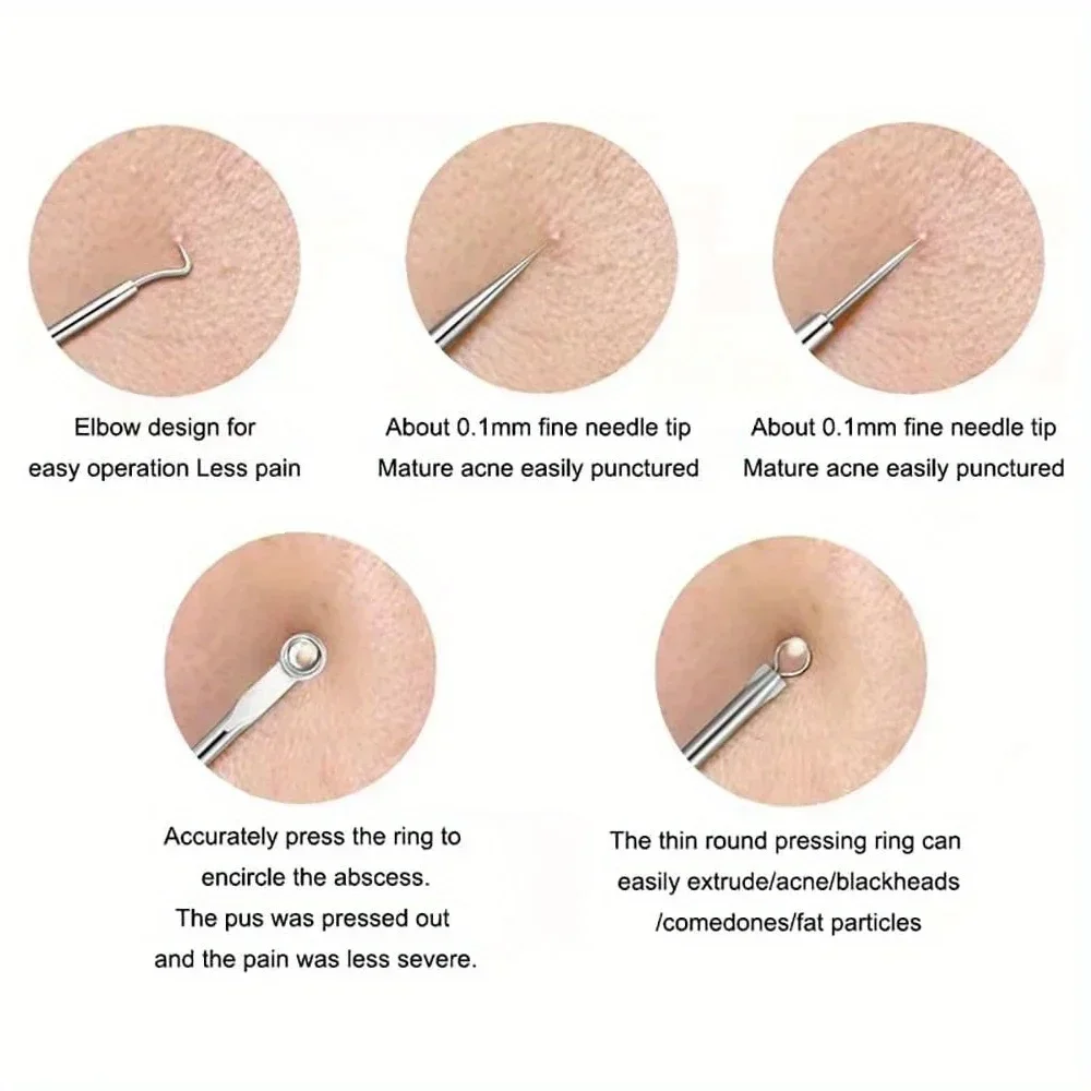 Agujas para eliminar espinillas, limpiador de puntos negros, Extractor de manchas de acero inoxidable, juego de agujas para tratamiento del acné, herramientas de cuidado de limpieza facial